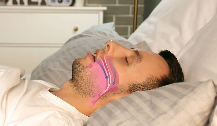 How Can I Stop Snoring?