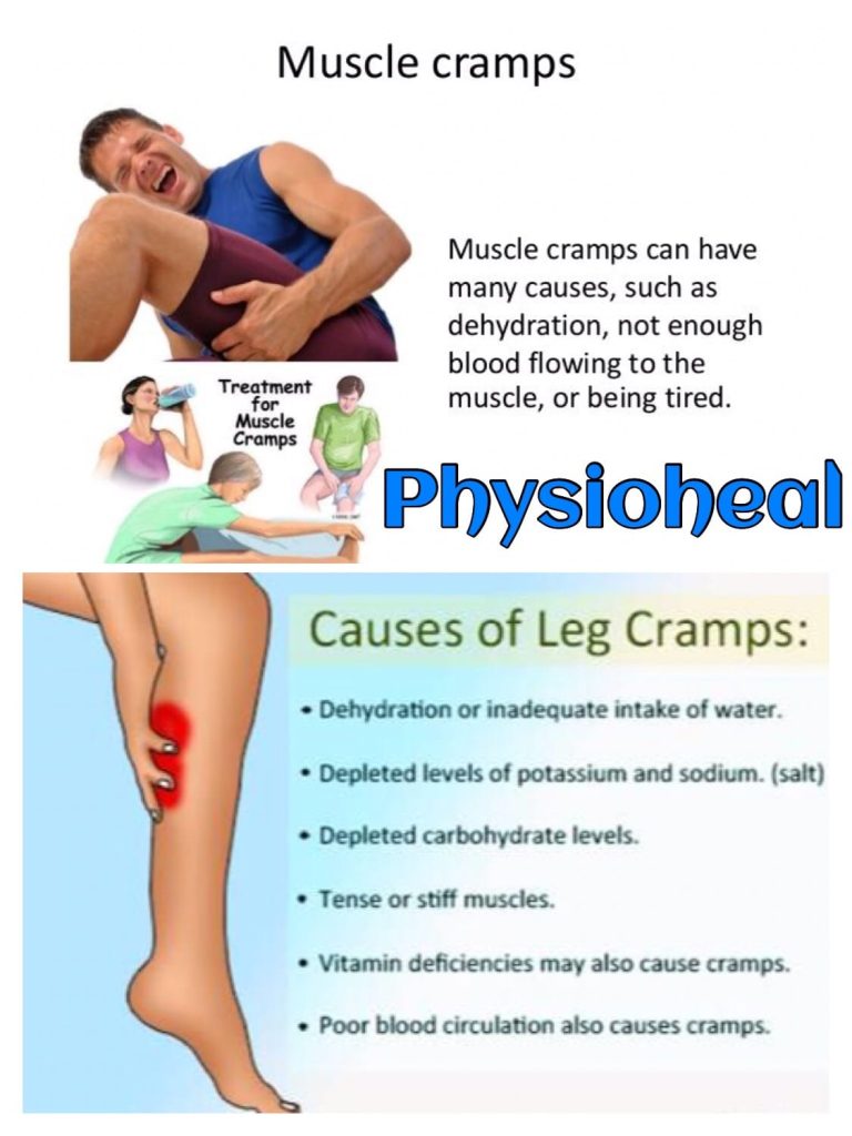 What Causes Leg Cramps At Night?