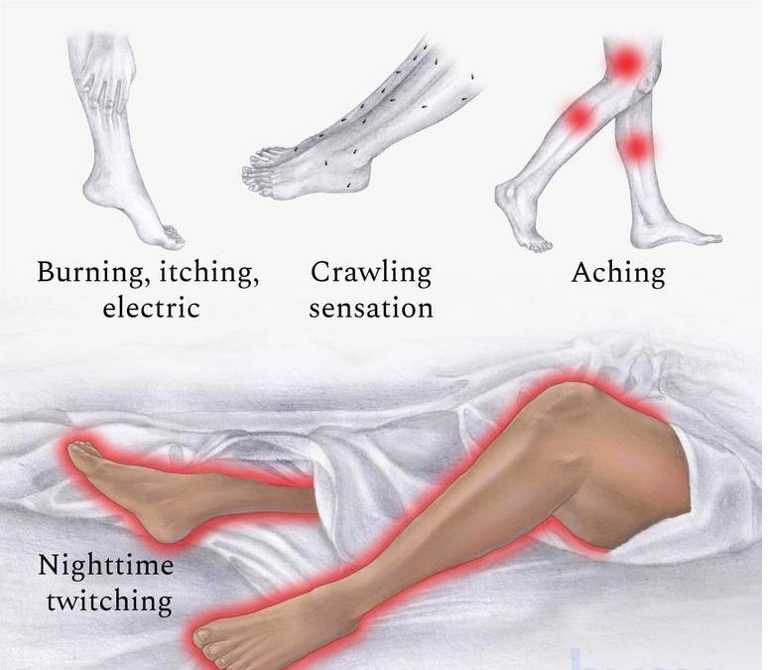 What Causes Restless Leg Syndrome?