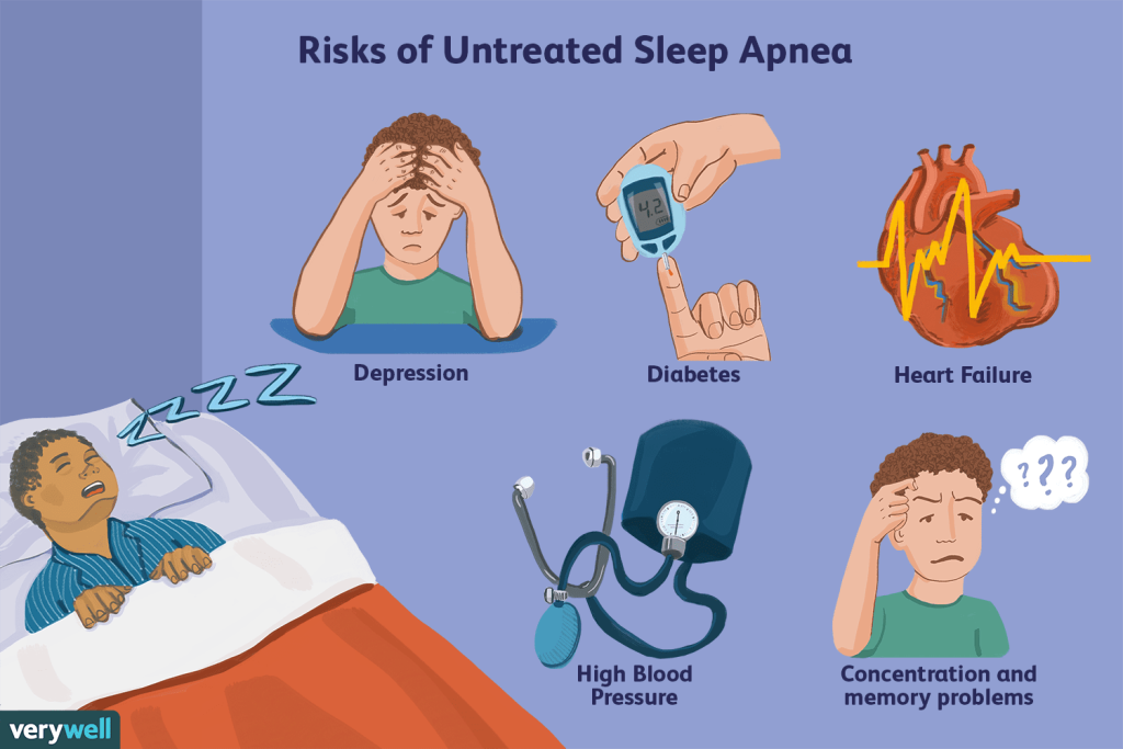 What Causes Sleep Apnea? What Causes Sleep Apnea?